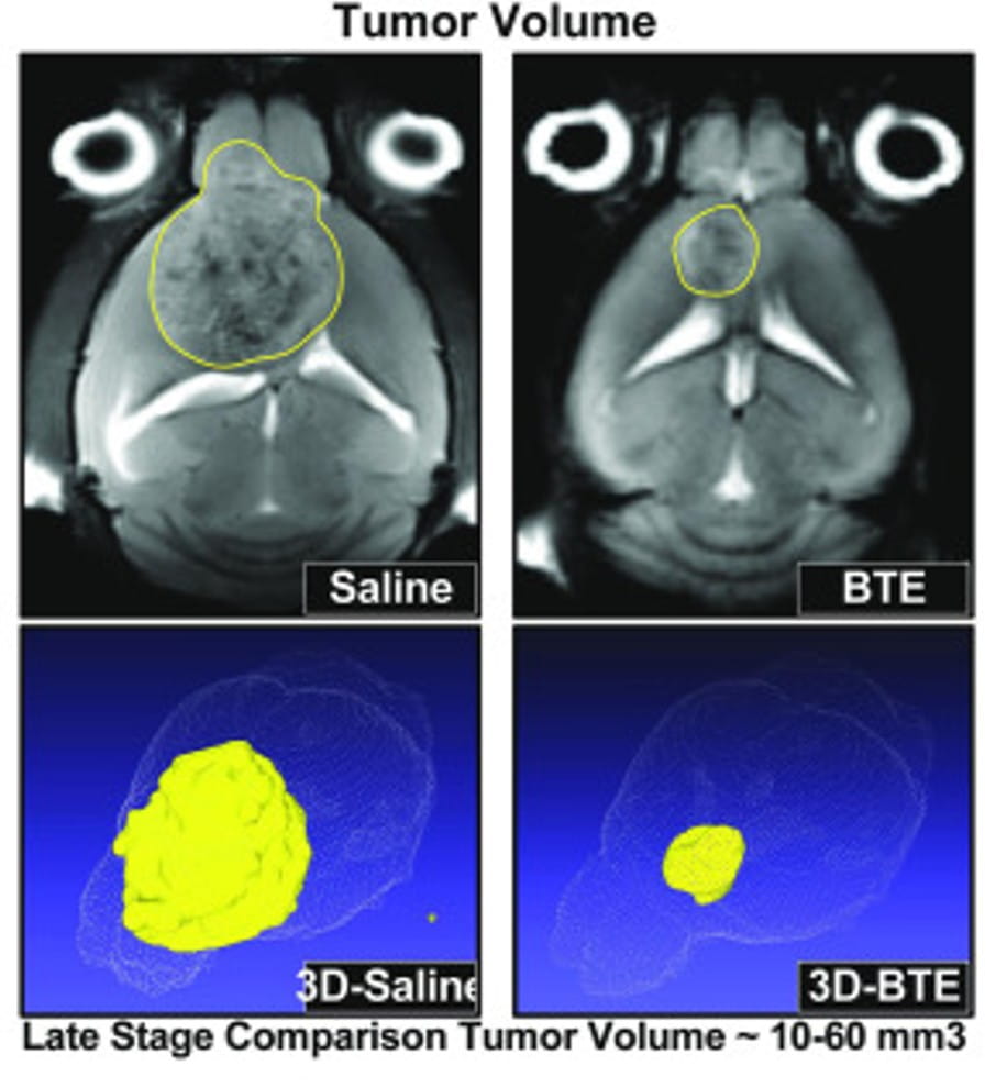Magnetic resonance imaging images of tumor volume in the BTE treatment and control mice.