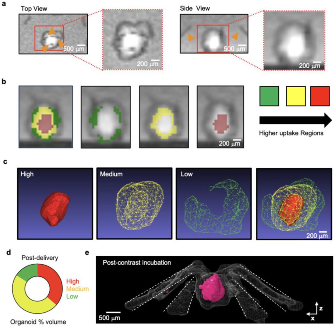 Contrast-enhanced magnetic resonance imaging images of a neural organoid.